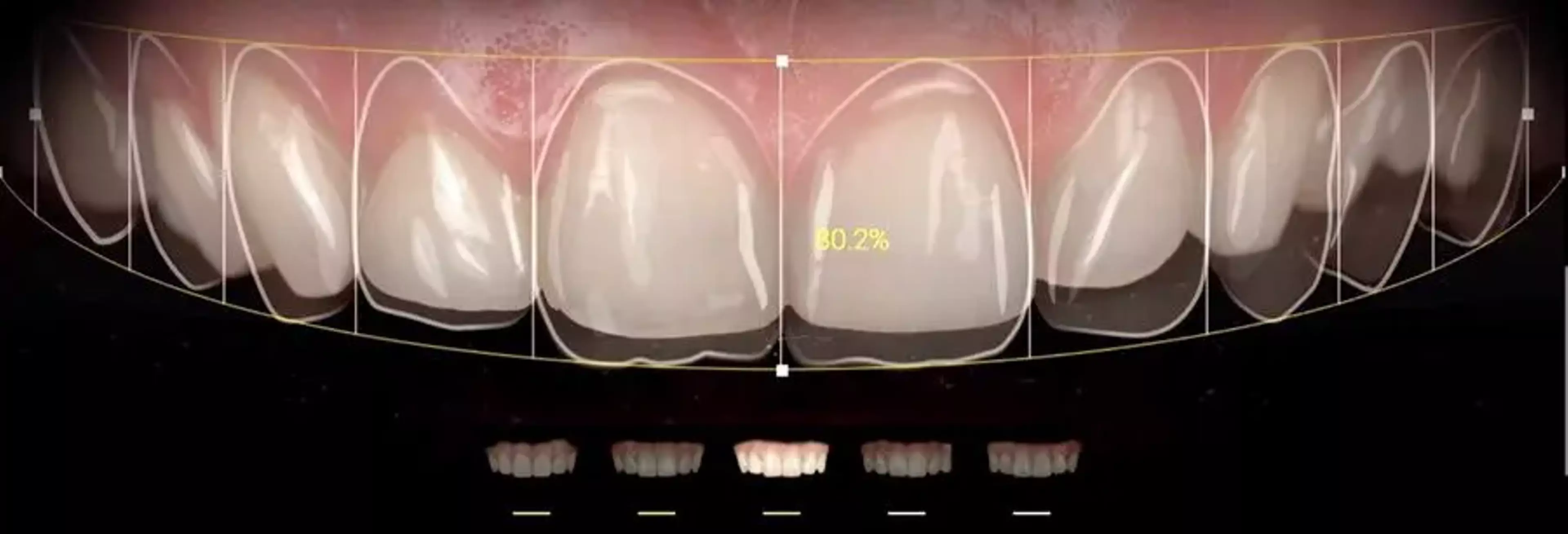 Digital smile Design