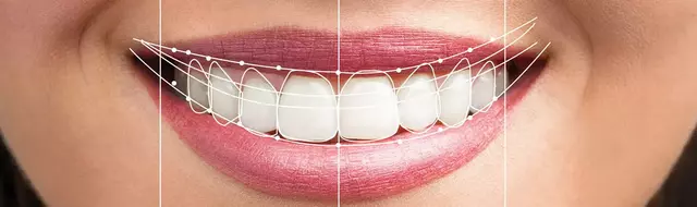 Digital smile Design