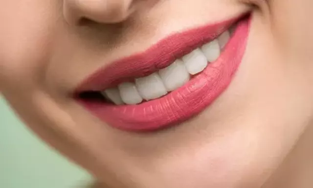 Veneers